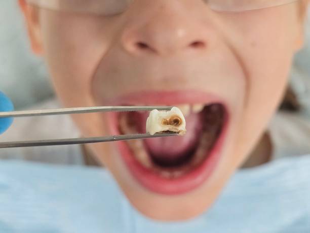 Best 24-Hour Emergency Dentist in Moody Af, GA