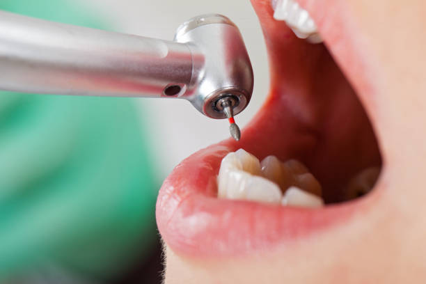 Best Walk-In Emergency Dentist in Moody Af, GA